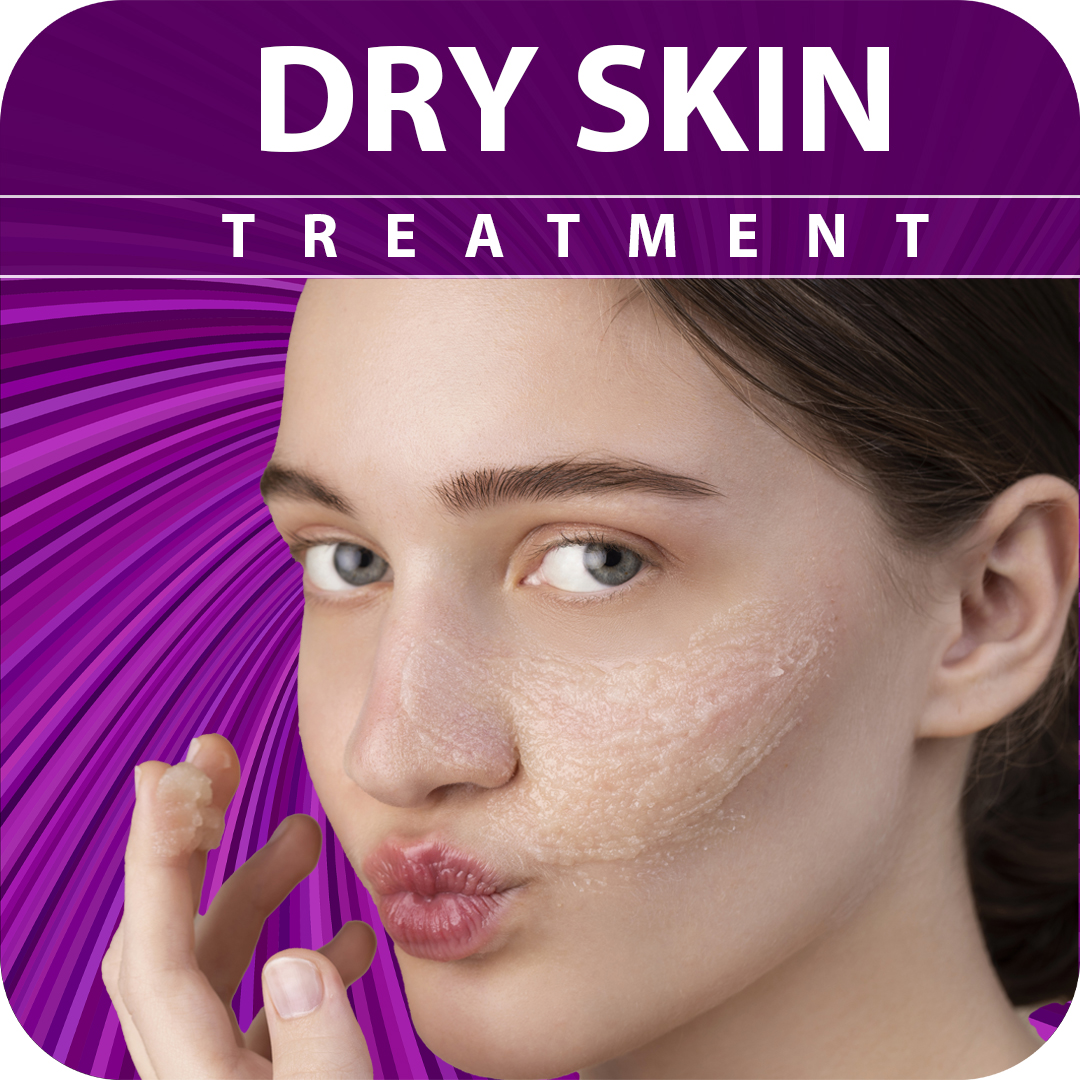 skin types